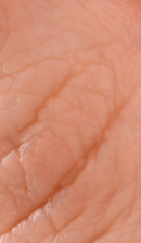 강남 인비절라인 치과 찾고 있다면 관련 이미지 27