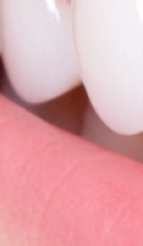 What to Check Before Choosing a Gangnam Laminate Dental Clinic image 37