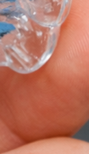 강남 교정전문의치과 고민된다면 관련 이미지 40