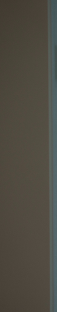 네비게이션 임플란트 식립과정 정확한 계획이 중요한 이유 관련 이미지 19