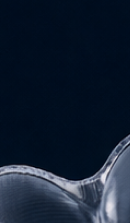 강남교정치과 결정 전 고려할 사항은 관련 이미지 28