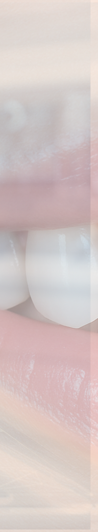 Looking Into Full Implant Placement Methods and Precautions image 35