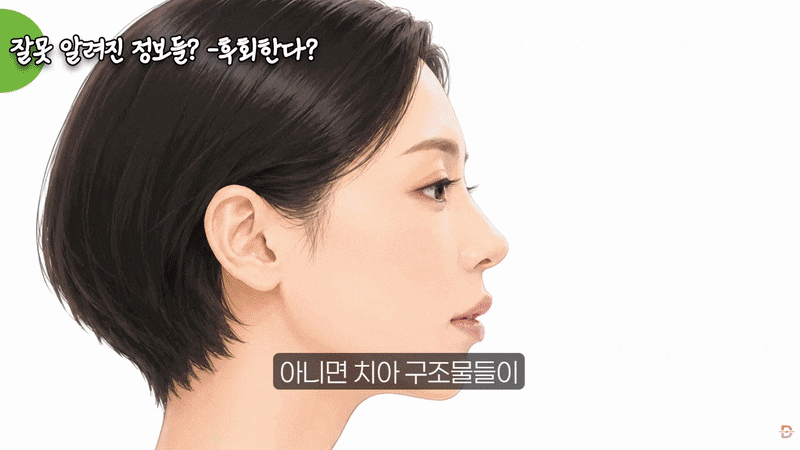 신사역 라미네이트, 자연스러운 인상을 위해 확인할 것들은? 관련 이미지 5