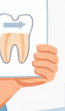 압구정 라미네이트치과 자연스러운 완성을 위한 선택 기준? 관련 이미지 34