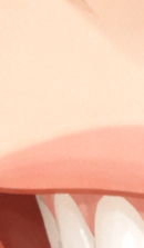 잠원역교정치과 선택 전 확인해야 할 의학적 진단 기준 관련 이미지 24