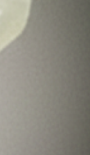 강남무삭제라미네이트치과 선택을 위한 정밀 정보 관련 이미지 32