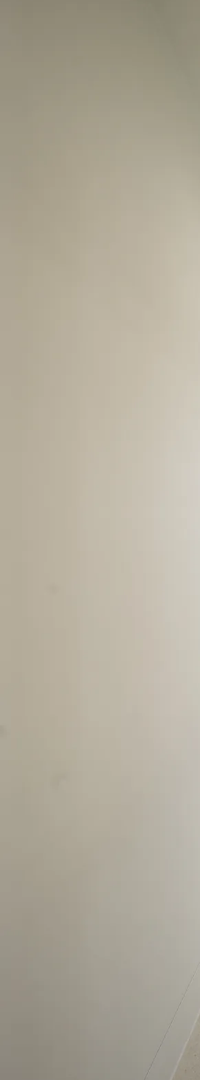 네비게이션 임플란트 식립과정 정확한 계획이 중요한 이유 관련 이미지 26