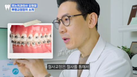 투명교정 무턱대고 했다간 후회합니다 관련 이미지 4