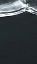 신사역치과 치아교정 전 꼭 확인해야 할 정밀 진단 기준 관련 이미지 39