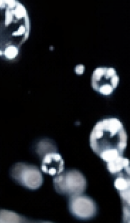 논현역 라미네이트 치과 후회 없는 선택을 위해 체크할 요소들 관련 이미지 27