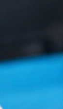 성인 돌출입 교정, 발치 없이도 변화가 가능할까? 관련 이미지 34