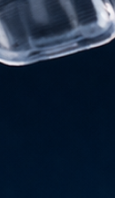 강남교정치과 결정 전 고려할 사항은 관련 이미지 36