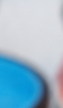 성인 돌출입 교정, 발치 없이도 변화가 가능할까? 관련 이미지 36