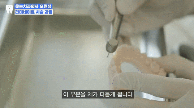 앞니 라미네이트 가격 00만 원? 진짜 중요한 건 따로 있어요 관련 이미지 7