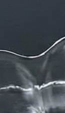 신사역치과 치아교정 전 꼭 확인해야 할 정밀 진단 기준 관련 이미지 30