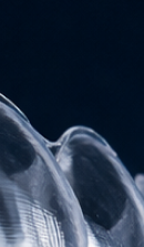 강남교정치과 결정 전 고려할 사항은 관련 이미지 32