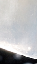 논현역 라미네이트 치과 후회 없는 선택을 위해 체크할 요소들 관련 이미지 31