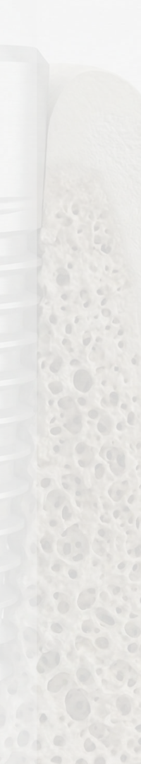 Invisalign Retainer Duration: A Detailed Look image 36