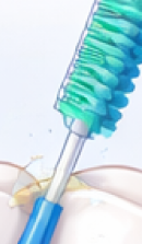 강남 교정치과 과정과 필수 분석 사항들 관련 이미지 32