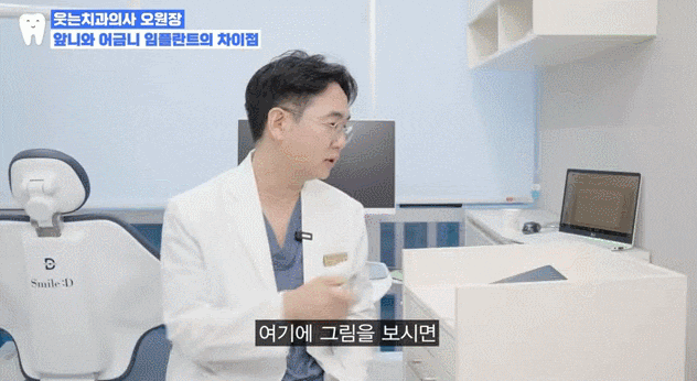 임플란트 OO하게 심으면 가짜 이빨 다 티납니다 관련 이미지 5