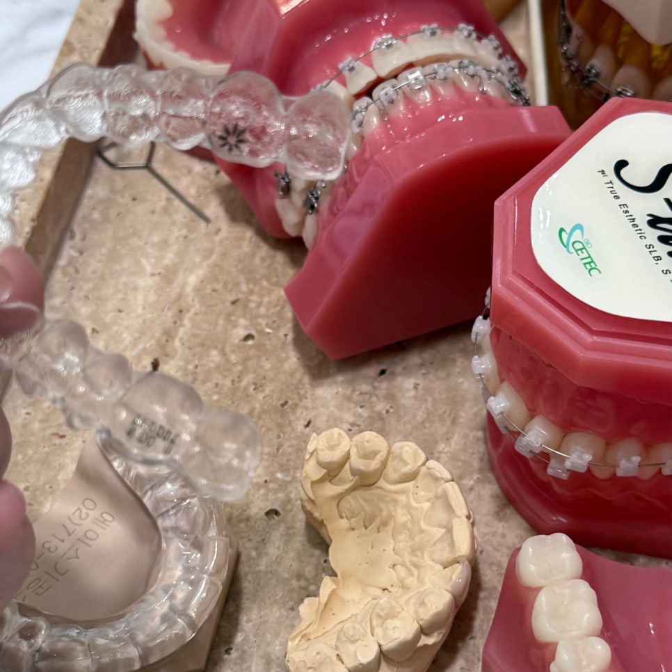 Does Invisalign Really Not Hurt? Do You Have to Have Teeth Extracted? image 5