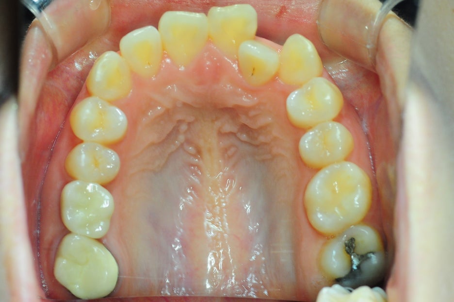 Invisalign Dentistry: What About This Place? Read This Before Asking image 7