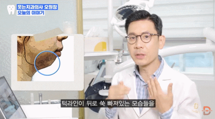 무턱교정 전후 사진만 찾아보고 있다면 반드시 확인해야 할 것들 관련 이미지 5