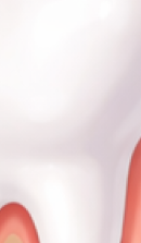 강남 교정치과 과정과 필수 분석 사항들 관련 이미지 40