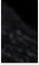 Curious About the Minimal-Preparation Laminate Procedure? image 34