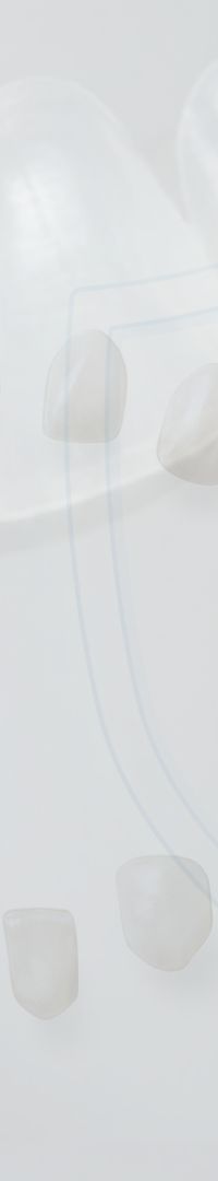 Things to Keep in Mind When Searching for a Laminate Dentistry Clinic Near Sinsa Station image 32