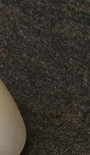 Systematic Examination Process to Review Before Deciding on Front Teeth Laminates image 31