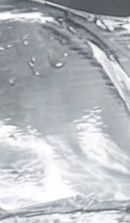 강남교정치과 선택 시 확인해야 할 핵심 기준과 정밀 진단 관련 이미지 32