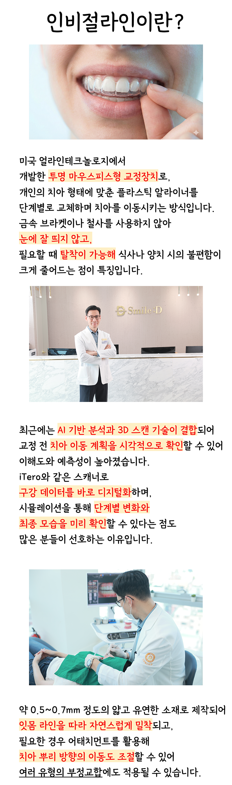 Invisalign Retainer Duration: A Detailed Look image 7