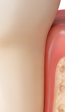 If You’re Considering a Seoul Implant Dental Clinic image 37