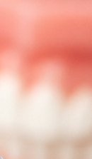 서울인비절라인치과 찾고 있다면 관련 이미지 31