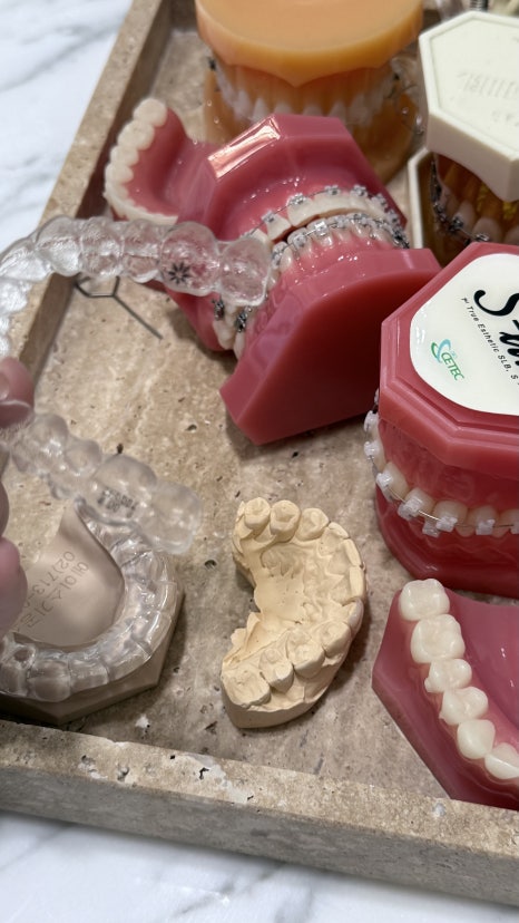 Clear Aligner Price? After 18 Years as a Dentist, I Think This Is More Important image 13