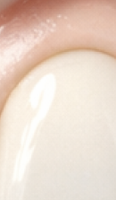 40대 치아 교정 고민 중이라면? 부담 줄이고 효율 높이는 선택법 관련 이미지 27