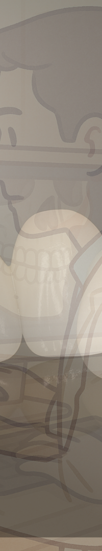 무삭제 라미네이트 추천 시작부터 결정까지 정리 관련 이미지 28