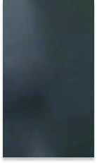 강남 임플란트 치과 초기 단계의 정밀한 분석이 중요한 이유 관련 이미지 33