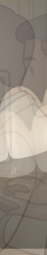 무삭제 라미네이트 추천 시작부터 결정까지 정리 관련 이미지 29