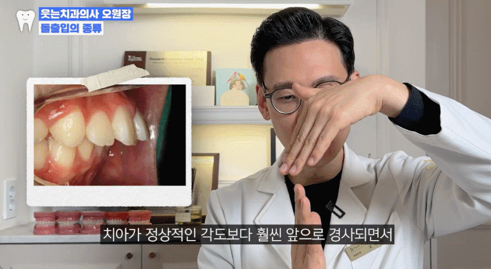 Non-extraction orthodontics? If you have this kind of protruding mouth, orthodontic treatment will not be effective image 12