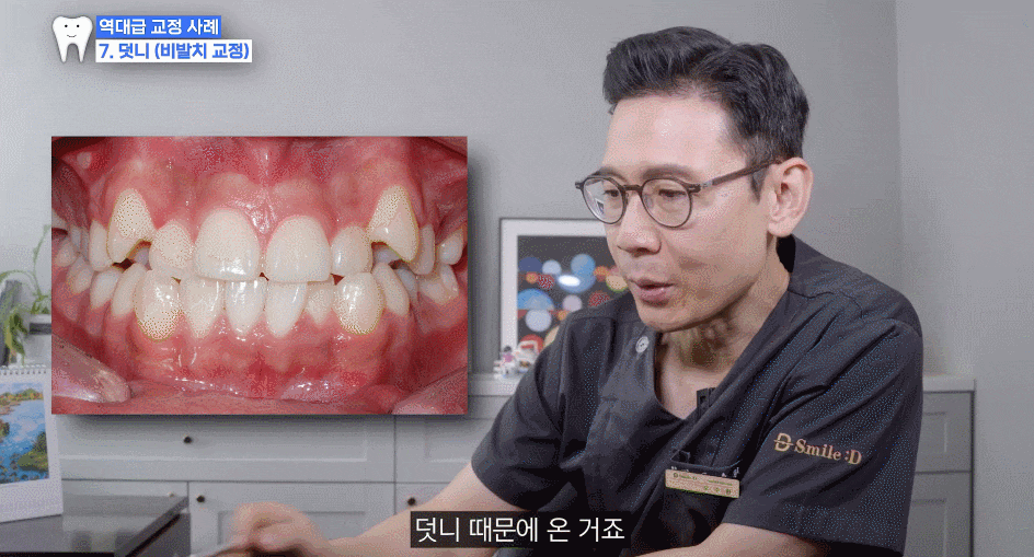 악궁확장 장치로 발치 피한 교정 사례, 나도 가능할까? 관련 이미지 4