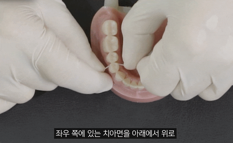 Flossing Order: Before Brushing? After? The Correct Way to Use Dental Floss image 2