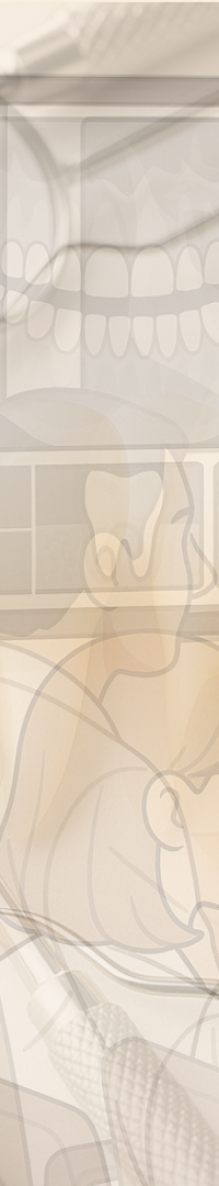 무삭제 라미네이트 추천 시작부터 결정까지 정리 관련 이미지 33