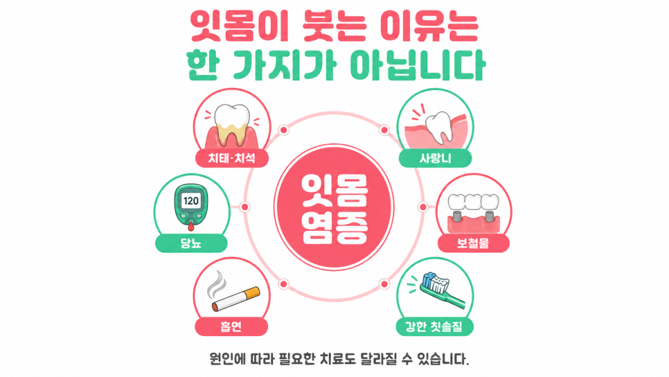 잇몸 염증, 붓고 피날 때 약보다 먼저 확인할 것은? 관련 이미지 4