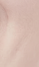 서울라미네이트치과 알아보고 있다면 관련 이미지 26