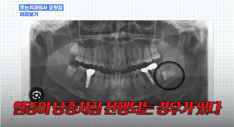 If medication doesn’t help when your gums are swollen, what are the causes and treatment options? image 4
