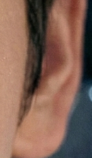 논현역교정치과 선택 전 반드시 확인해야 할 체크 포인트 관련 이미지 40