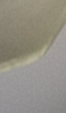 강남무삭제라미네이트치과 선택을 위한 정밀 정보 관련 이미지 39