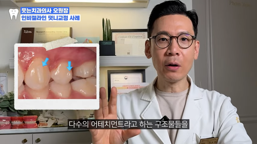 인비절라인후기로 알아본 인비절라인치과 선택 Tip 관련 이미지 2